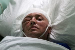 Прикутий до ліжка герой АТО бореться і не здається