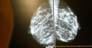 Рак – не вирок: у Дніпрі онкохворих успішно лікують за допомогою винаходу нобелівських лауреатів