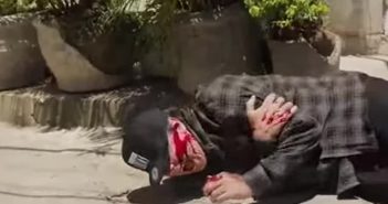 Дмитра Комарова "підстрелили" у Бразилії