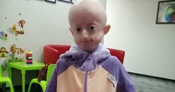 Іринка Химич передчасне старіння організму