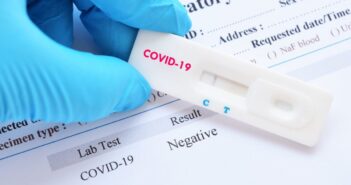 плр тест коронавірус