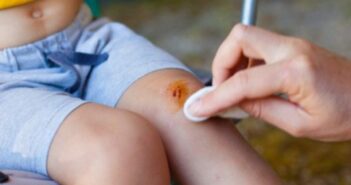 правець дитина рана лікування травма