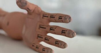 протез рука реабілітація